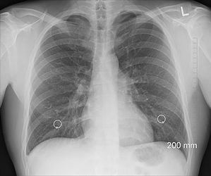 RESPIRATION: BREATHING, AND EXCHANGE OF GASES 3 post name
