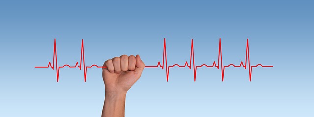 Inappropriate sinus tachycardia: symptoms and treatment. 1 sinus tachycardia